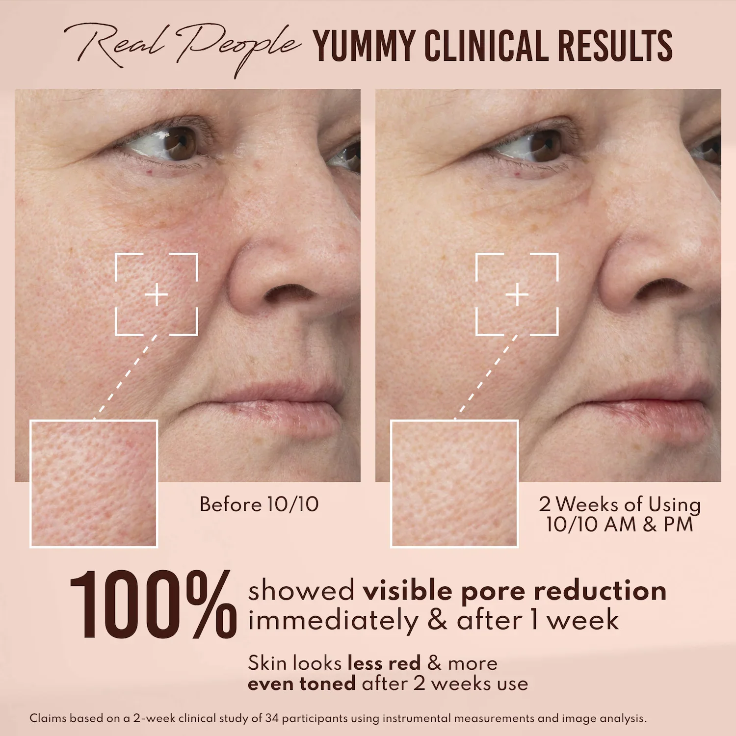 Yummy Skin 10/10 Barrier Boost Hyaluronic Acid + Ectoin Plumping Serum — foto 6 de 10