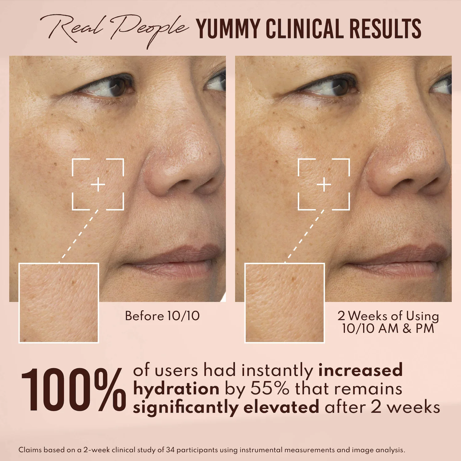 Yummy Skin 10/10 Barrier Boost Hyaluronic Acid + Ectoin Plumping Serum — foto 4 de 10