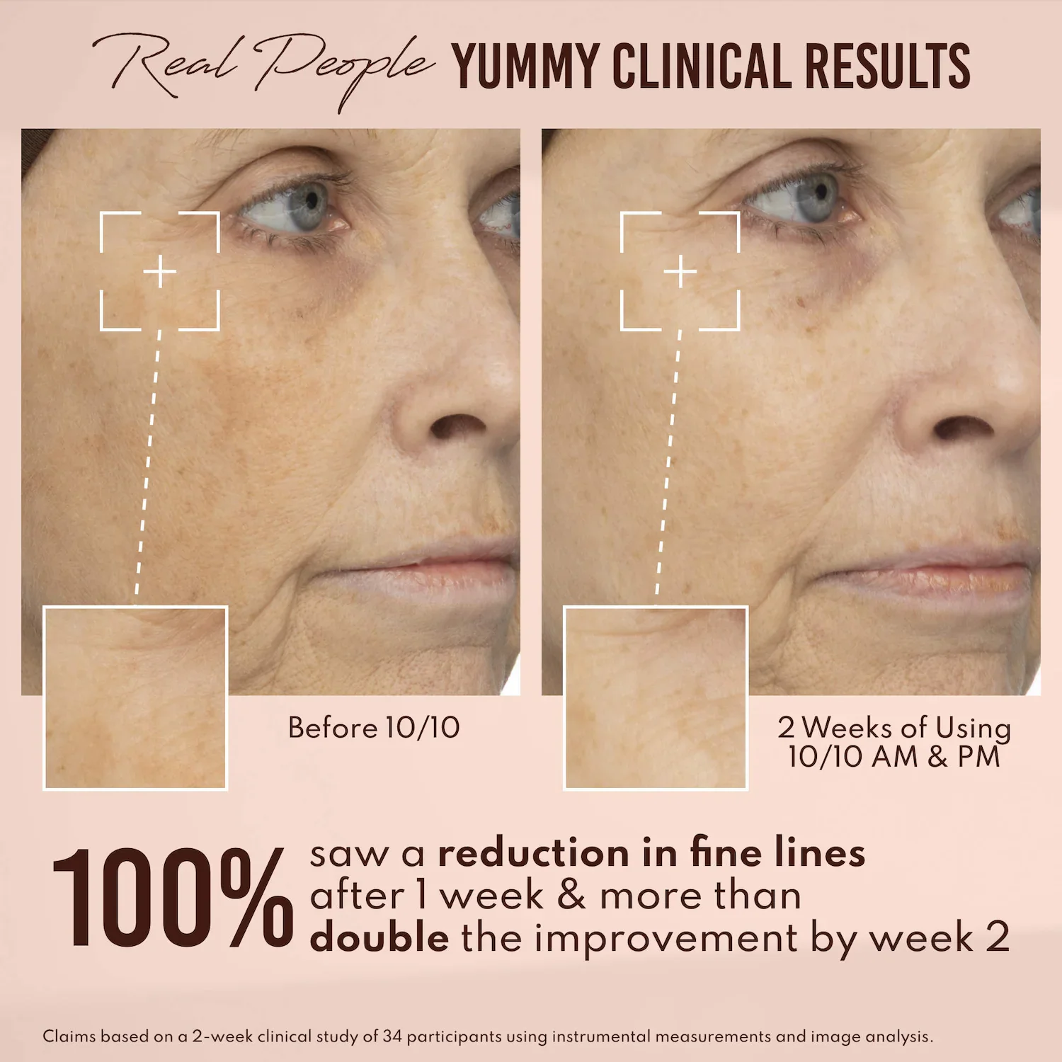 Yummy Skin 10/10 Barrier Boost Hyaluronic Acid + Ectoin Plumping Serum — foto 5 de 10