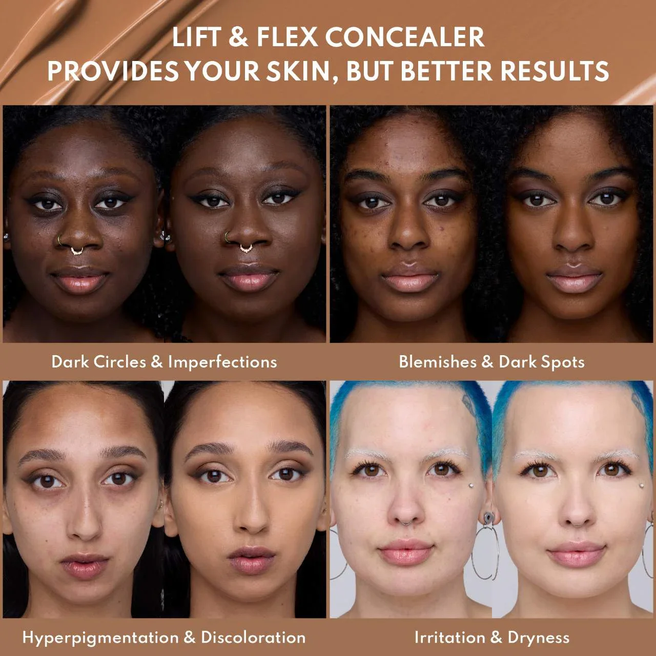 Yummy Skin Lift & Flex Hydrating Concealer With Hyaluronic Acid & Caffeine — foto 8 de 30